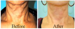 bpm-images-659565